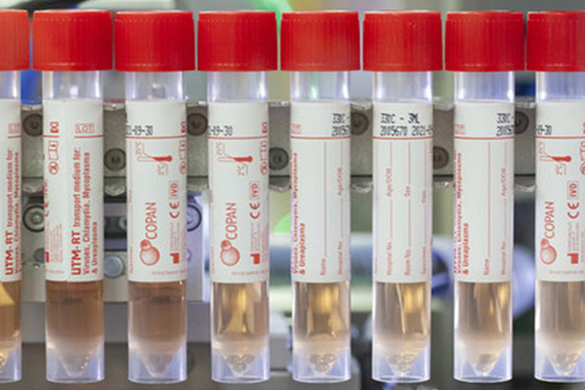 Sistemas de transporte y recolección de virus y bacterias intracelulares