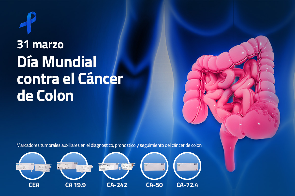 Marcadores tumorales auxiliares en el diagnóstico, pronóstico y seguimiento del Cáncer de Colon