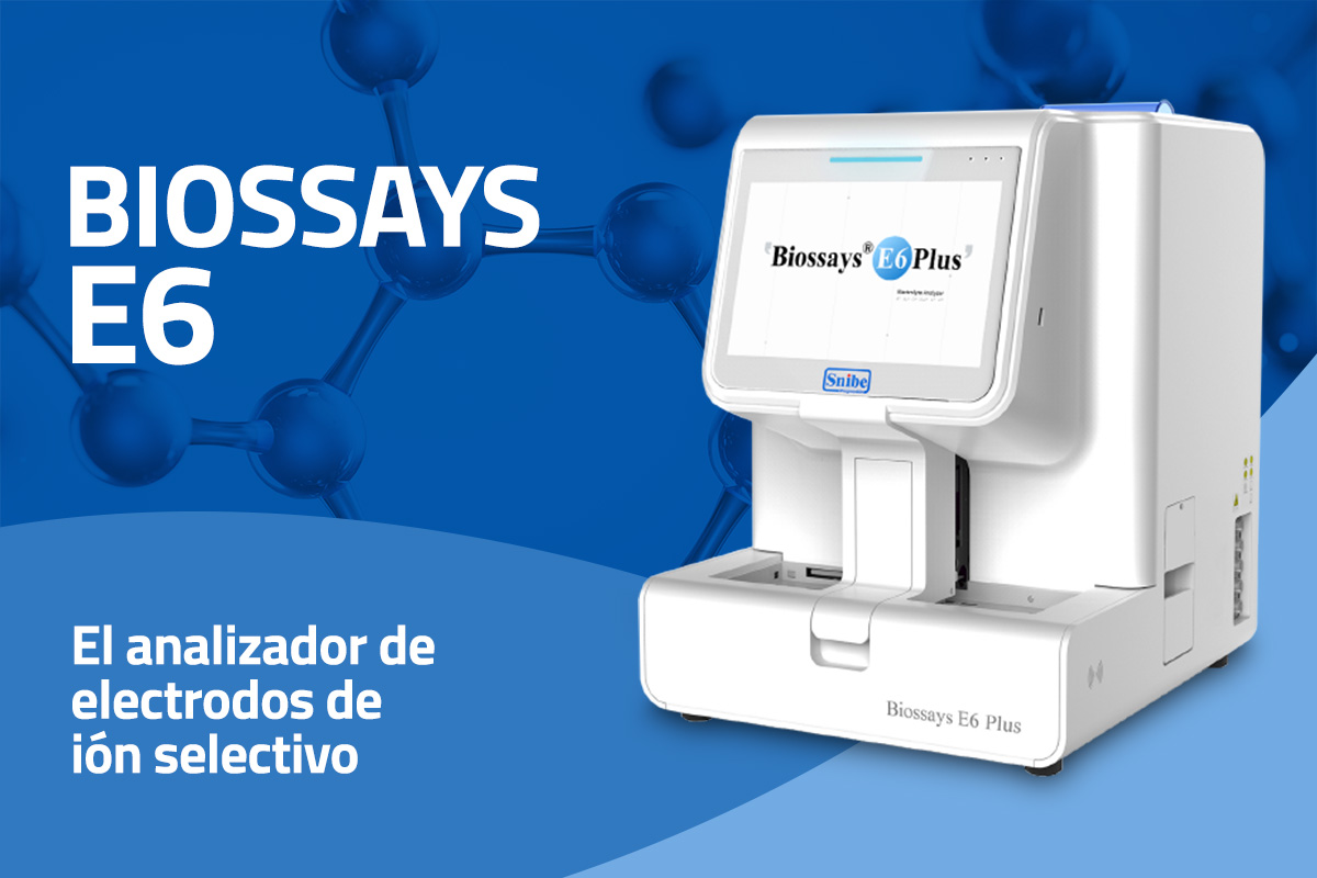 Electrodos de ion selectivo: qué son y por qué importan