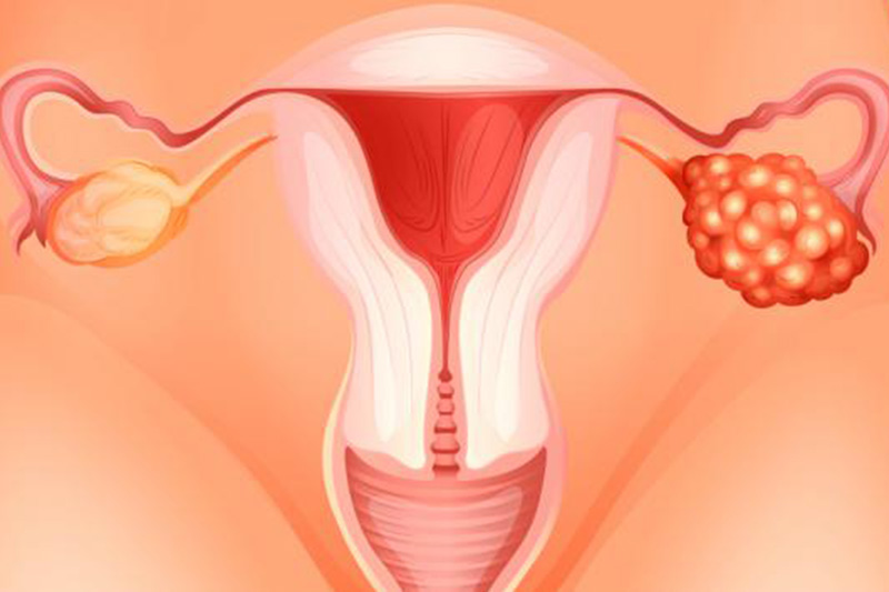 Proteína Epididimal Humana 4 (HE4): Una Biomarcador Significativa en la Salud y la Enfermedad